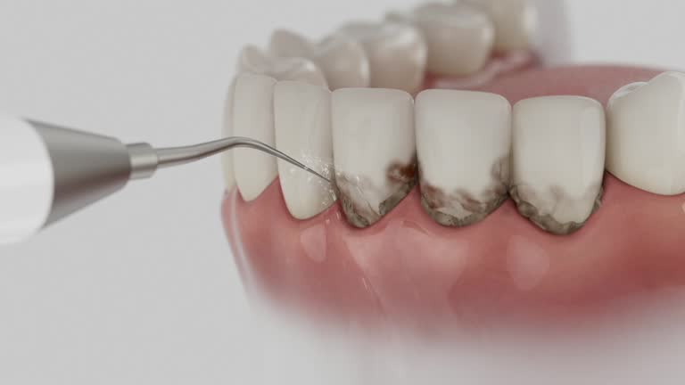 Reliable Emergency Dentist contractor in Shell Ridge, CA by Smile Center Dentistry